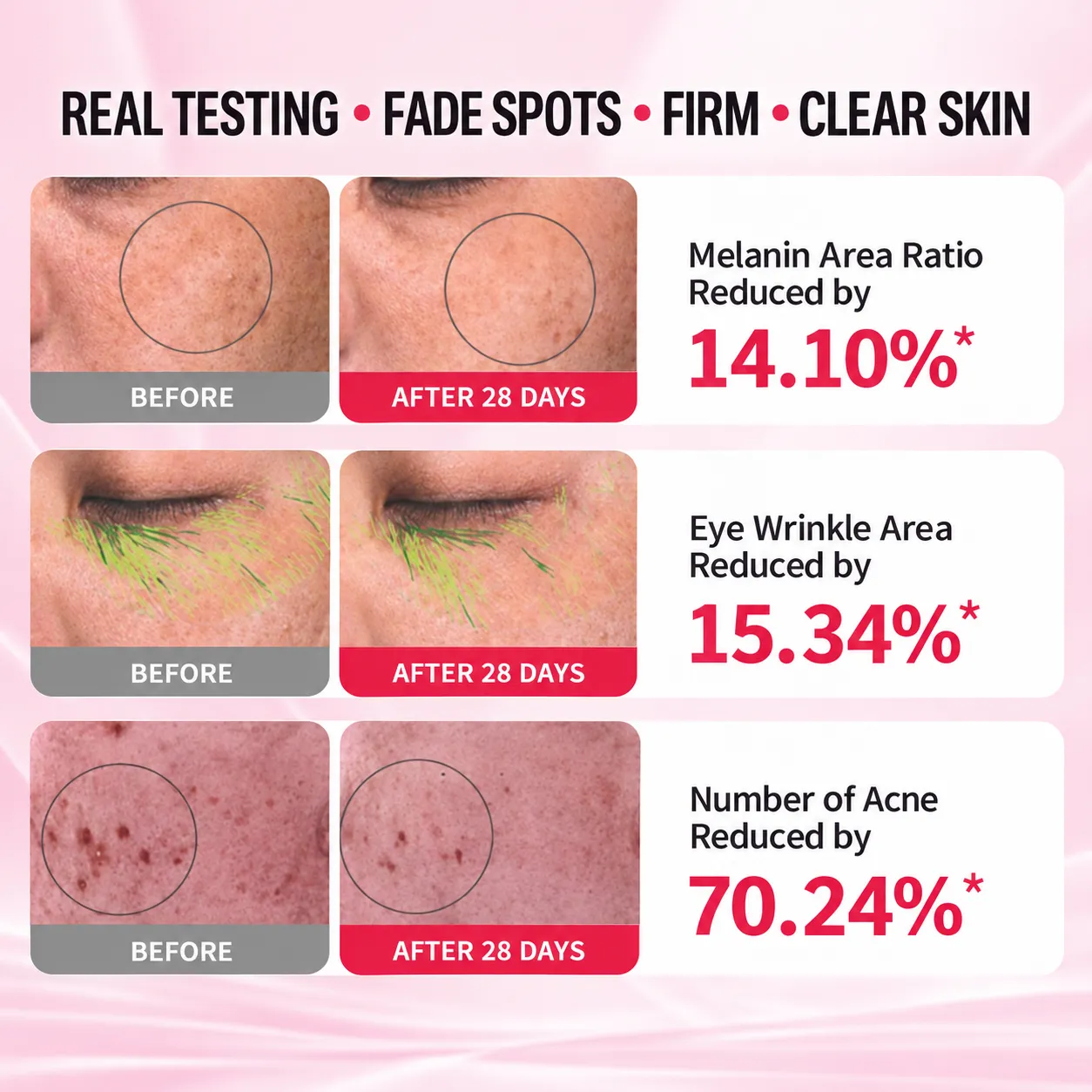 28 days before and after skin test for 7 color LED facial mask, fade spots, reduce acne and wrinkles
