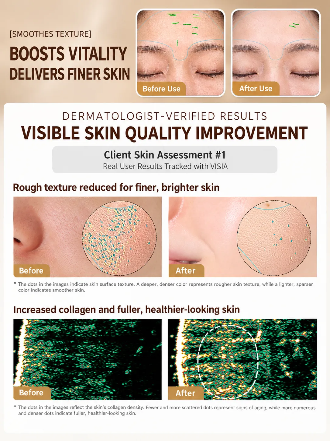 Dermatologist-verified results showing reduced rough texture and increased collagen using the PLUS Flagship beauty device.